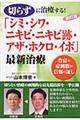 切らずに治療する！「シミ・シワ・ニキビ・ニキビ跡・アザ・ホクロ・イボ」最新治療　新訂版