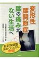 変形性膝関節症膝の痛みがない生活へ