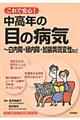 これで安心！中高年の目の病気