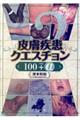 畆NGX`POOvX