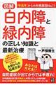 図解白内障と緑内障の正しい知識と最新治療