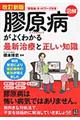 図解膠原病がよくわかる最新治療と正しい知識　改訂新版