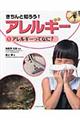 きちんと知ろう!アレルギー 1