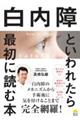 白内障といわれたら最初に読む本