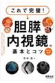 これで完璧!胆膵内視鏡の基本とコツ