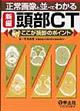 正常画像と並べてわかる新編頭部CT
