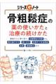 骨粗鬆症の薬の使いかたと治療の続けかた