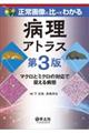 正常画像と比べてわかる病理アトラス　第３版