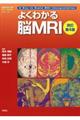 よくわかる脳ＭＲＩ　改訂第４版