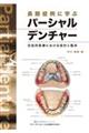 長期症例に学ぶパーシャルデンチャー