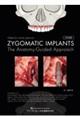 ＺＹＧＯＭＡＴＩＣ　ＩＭＰＬＡＮＴＳ　日本語版