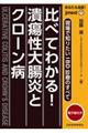 あなたも名医！比べてわかる！潰瘍性大腸炎とクローン病