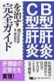 Ｂ型肝炎・Ｃ型肝炎を治す完全ガイド