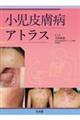 畆aAgX