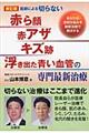 医師による切らない「赤ら顔・赤アザ・キズ跡・浮き出た青い血管」の専門最新治療 新訂版