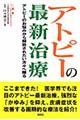 アトピーの最新治療