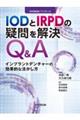 ＩＯＤとＩＲＰＤの疑問を解決Ｑ＆Ａ