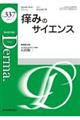 痒みのサイエンス