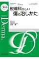 皮膚科らしい傷の治しかた