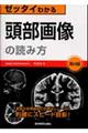 ゼッタイわかる頭部画像の読み方 第4版