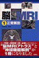 脳ＭＲＩ　１