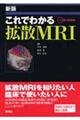 これでわかる拡散ＭＲＩ　新版