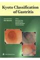 Ｋｙｏｔｏ　Ｃｌａｓｓｉｆｉｃａｔｉｏｎ　ｏｆ　Ｇａｓｔｒｉｔｉｓ