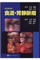 食道・胃静脈瘤 改訂第4版
