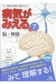 病気がみえる vol.7 第3版