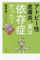 アトピー性皮膚炎、実は依存症だった！