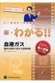 tKX