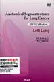 肺癌の解剖学的区域切除術左肺